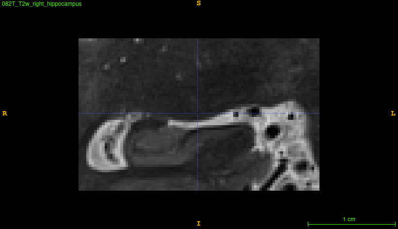 Sample hippocampus